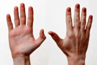 چرا انگشتان دست انسان این‌گونه شکل گرفته‌اند؟